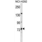 MUM1 Like 1 (MUM1L1) Antibody