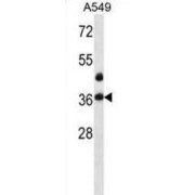 LIM And SH3 Domain Protein 1 (LASP1) Antibody