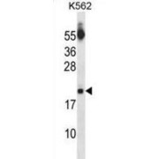 Synaptosomal-Associated Protein 18 (SAP18) Antibody