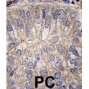 Cadherin 3 (CDH3) Antibody