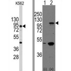 Cadherin 3 (CDH3) Antibody