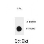 ATRIP (pS239) Antibody