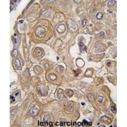 Toll-Like Receptor 6 (TLR6) Antibody