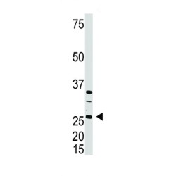 Dickkopf-Related Protein 4 (DKK4) Antibody