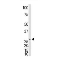 Dickkopf-Like 1 (DKKL1) Antibody