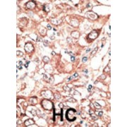 Gap Junction Protein Beta 2 (GJB2) Antibody
