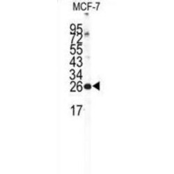 Neuronal Calcium Sensor 1 (NCS1) Antibody