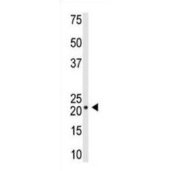 Visinin-Like Protein 1 (VILIP1) Antibody