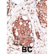 Visinin-Like Protein 3 (VILIP3) Antibody