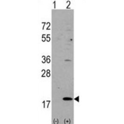 Visinin-Like Protein 3 (VILIP3) Antibody