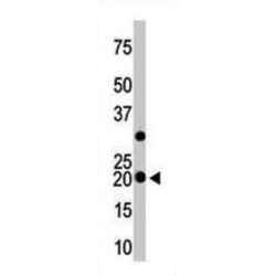 Visinin-Like Protein 3 (VILIP3) Antibody