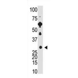 Recoverin (RCVRN) Antibody