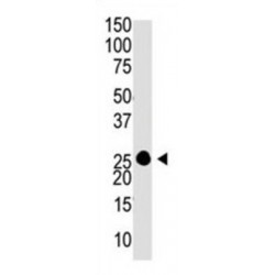 Guanylyl Cyclase-Activating Protein 1 (GUCA1A) Antibody