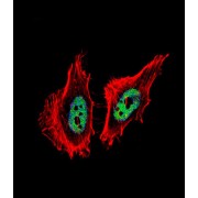 C-Terminal-Binding Protein 1 (CTBP1) Antibody