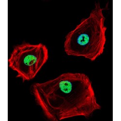 C-Terminal-Binding Protein 1 (CTBP1) Antibody