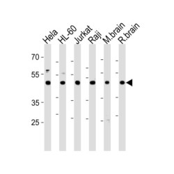 C-Terminal-Binding Protein 1 (CTBP1) Antibody