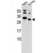 KRAS2 Antibody