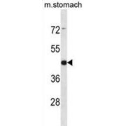 Arrestin Domain-Containing Protein 1 (ARRDC1) Antibody