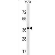 CAP-Gly Domain Containing Linker Protein 4 (CLIP4) Antibody