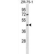 Olfactory Receptor 2T6 (OR2T6) Antibody