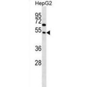 FAM83A Antibody