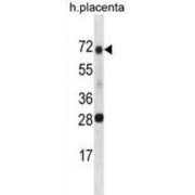 Serine Peptidase Inhibitor, Kunitz Type 1 (SPINT1) Antibody