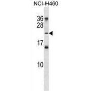 Troponin I, Fast Skeletal Muscle (TNNI2) Antibody