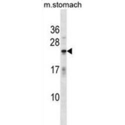 Troponin I, Fast Skeletal Muscle (TNNI2) Antibody