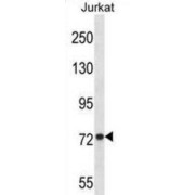 Mitofusin 1 (MFN1) Antibody