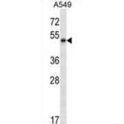 Pancreatic Triacylglycerol Lipase (PNLIP) Antibody