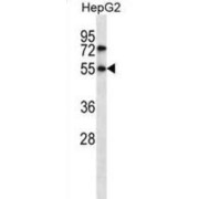 Nuclear Receptor Subfamily 4 Group A Member 3 (NR4A3) Antibody