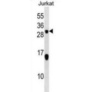 Stathmin 2 (STMN2) Antibody