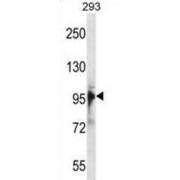 RNA Binding Motif Protein 10 (RBM10) Antibody