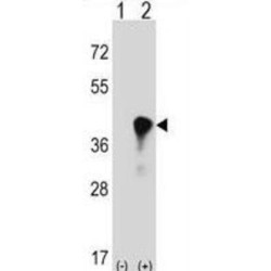 C4b-Binding Protein Beta Chain (C4BPB) Antibody