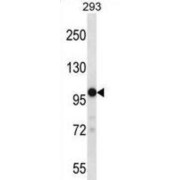 Transient Receptor Potential Cation Channel Subfamily M Member 4 (TRPM4) Antibody