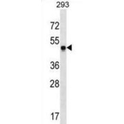Sorting Nexin 17 (SNX17) Antibody
