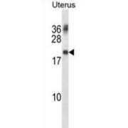 Peripheral Myelin Protein 22 (PMP22) Antibody