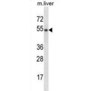 GATA Binding Protein 3 (GATA3) Antibody