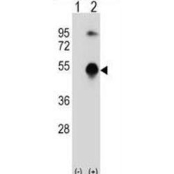 GATA Binding Protein 3 (GATA3) Antibody