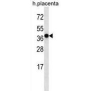 Olfactory Receptor 5H2 (OR5H2) Antibody