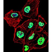 Heterogeneous Nuclear Ribonucleoprotein D (HNRNPD) Antibody