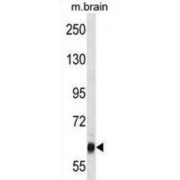 Vacuolar Protein Sorting-Associated Protein 45 (VPS45) Antibody