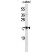 Thymic Stromal Lymphopoietin (TSLP) Antibody