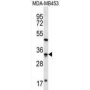 Putative tRNA (cytidine(32)/guanosine(34)-2'-O)-Methyltransferase (FTSJ1) Antibody