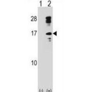 Galectin 10 (CLC) Antibody