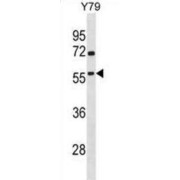 TATA-Box Binding Protein Associated Factor, RNA Polymerase I Subunit A (TAF1A) Antibody