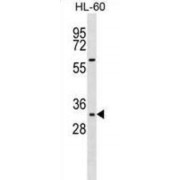 Homeobox Protein Hox-B13 (HOXB13) Antibody
