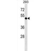 Cyclin-Dependent Kinase 9 (CDK9) Antibody