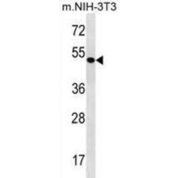 Cyclin-Dependent Kinase 9 (CDK9) Antibody