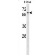 ArfGAP With FG Repeats 1 (AGFG1) Antibody